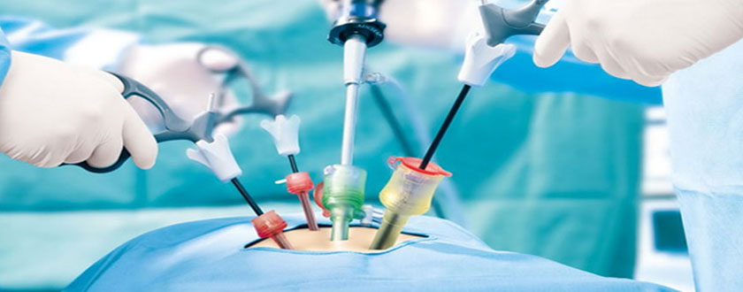 General and Laparoscopy Surgery